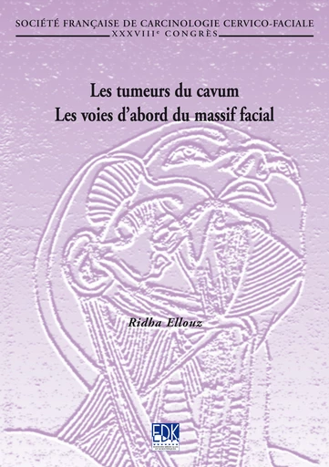 Les tumeurs du cavum - Ridha Ellouz - EDP Sciences