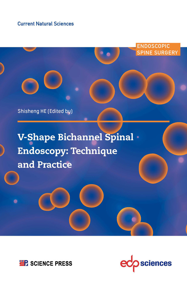 V-Shape Bichannel Spinal Endoscopy: Technique and Practice -  - EDP Sciences & Science Press